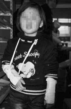 一個小女孩，雙手裹著（zhe）繃帶，臉（liǎn）上還（hái）有（yǒu）很多（duō）血痕